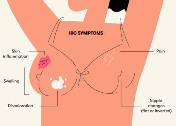 Get the Latest Breast Cancer Information and Reduce Your Risk Factors