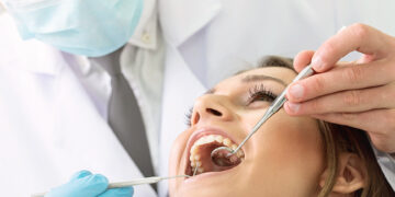 Home Remedies For Cavity – What You Need to Know!