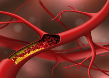 Cholesterol-Lowering Diet Plan For Beginners